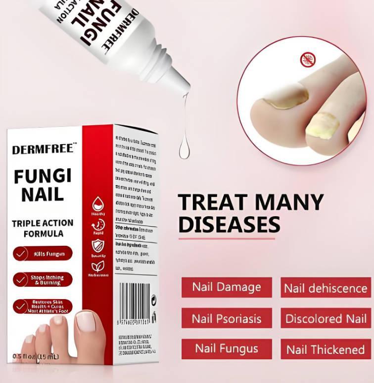 Whitenail Repair Liquid - Deep Penetrating Root Antibacterial Promotion For Healthy New Nail Growth